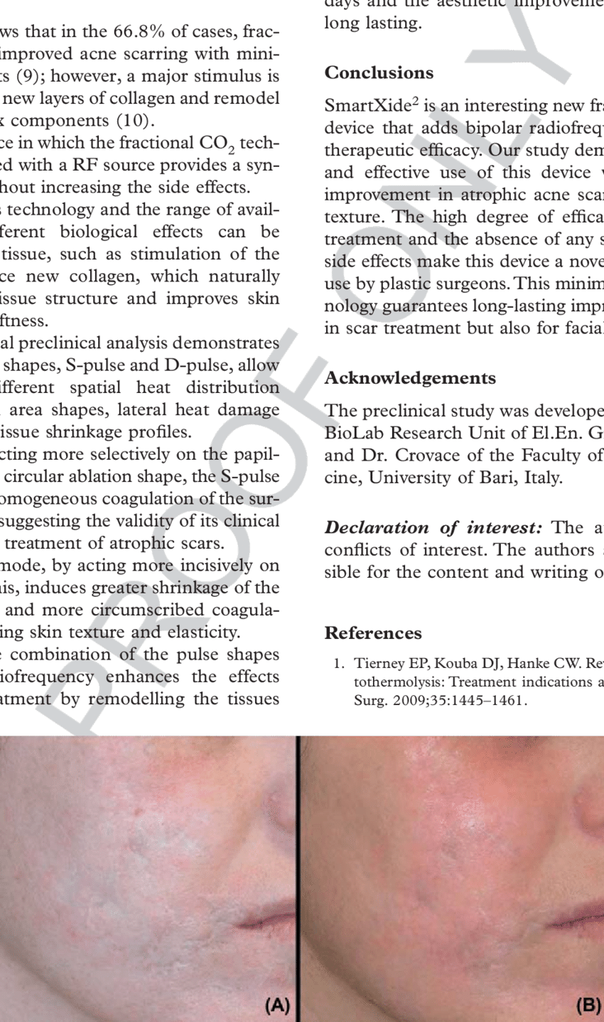 Before And (b) After 6 Month Follow Up - Science (850x1438), Png Download