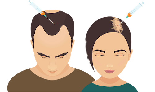 Prp Hair Loss - Stop Hair Loss Cartoon (500x298), Png Download