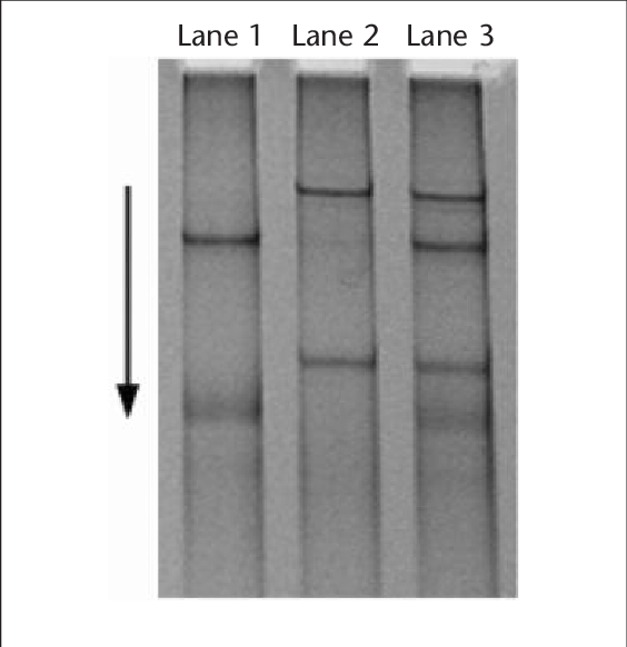 Caused By A T C Transition In The Sodium Channel, Voltage-gated, - Monochrome (564x582), Png Download
