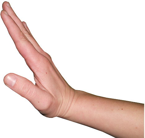 Keep Your Dog Away - Dorsiflexion Of The Hand (640x480), Png Download