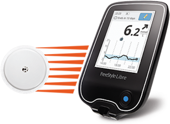 Say Goodbye To Finger Sticks - Abbott Freestyle Libre Sensor Flash Blood Glucose Monitoring (600x458), Png Download