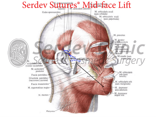 M Temporoparietalis (500x500), Png Download