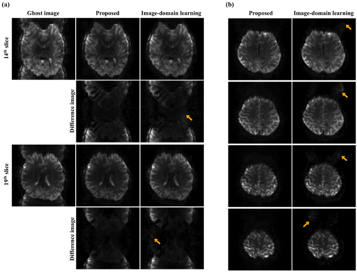 Comparison With The Image-domain Learning - Monochrome (750x545), Png Download