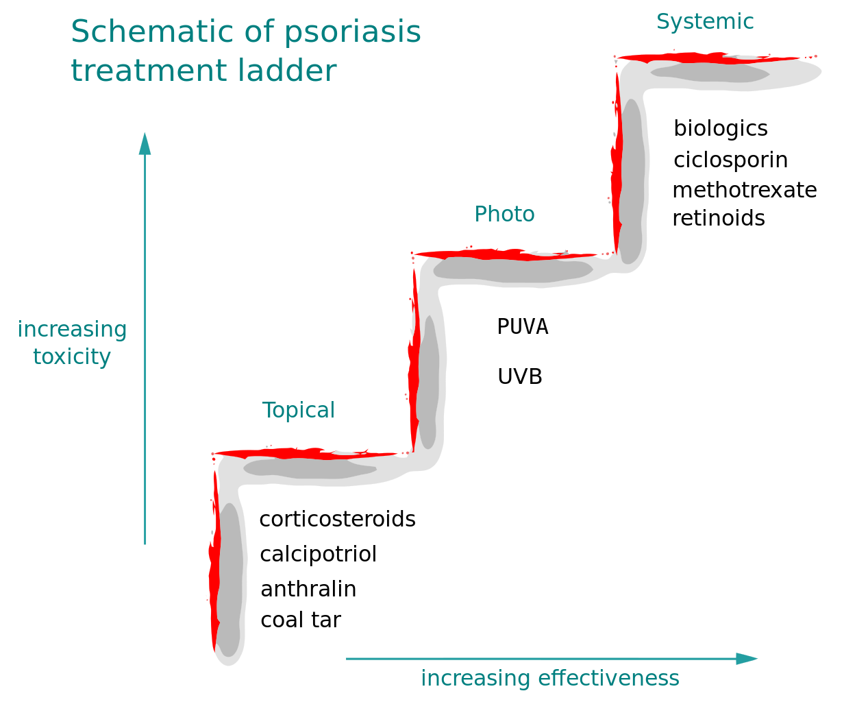 Psoriasis Treatment Ladder - Psoriasis Ladder (1267x1024), Png Download