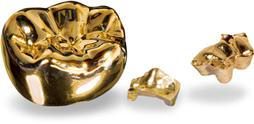 Pfm Lab Outsourcing Services - Cast Restorations (500x387), Png Download