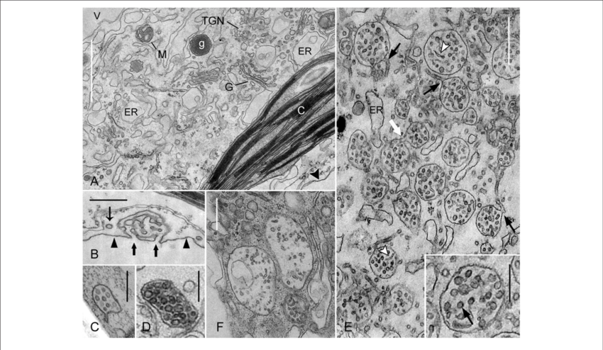 Effect Of Wortmannin On Mvbs In Chara Internodal Cells - Chara (850x494), Png Download