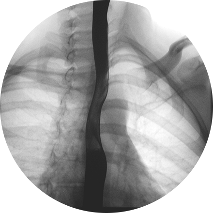 Fluoroscopy X Ray (440x440), Png Download