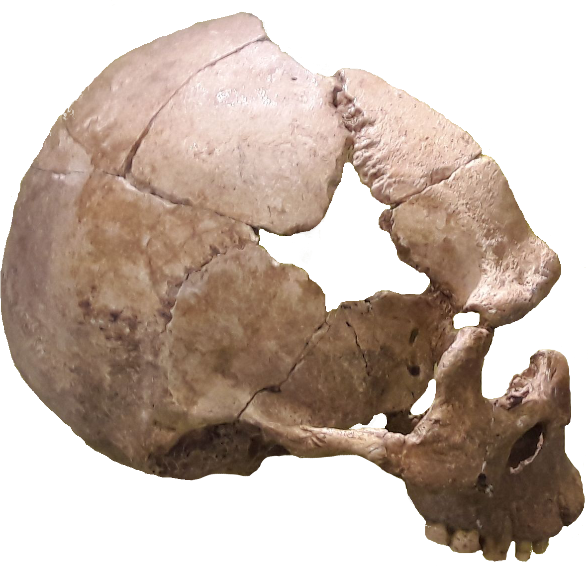 Rhünda Skull (1210x1156), Png Download
