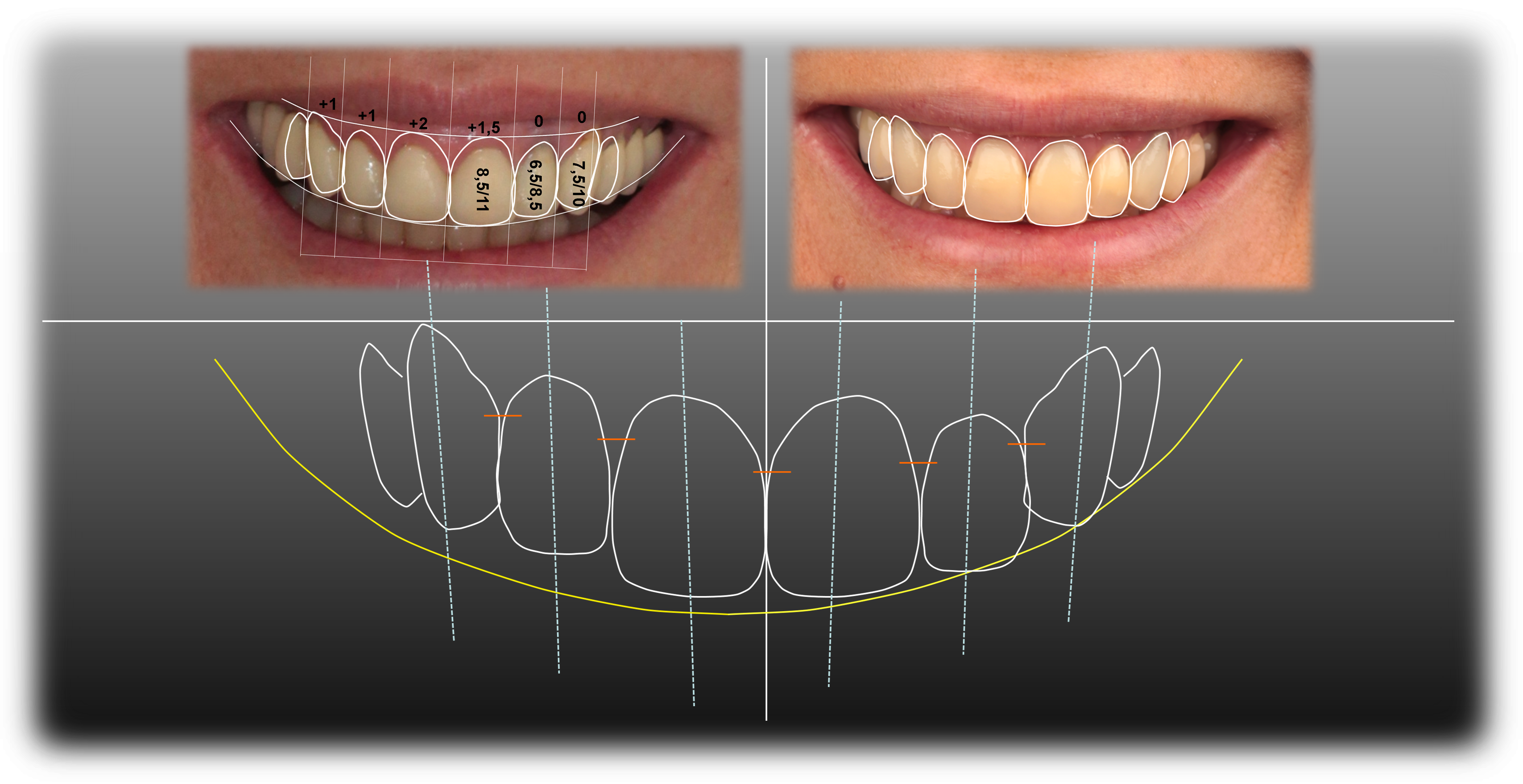 Silvestre Ripoll Clínica Dental - Diseño De La Sonrisa (3414x1760), Png Download