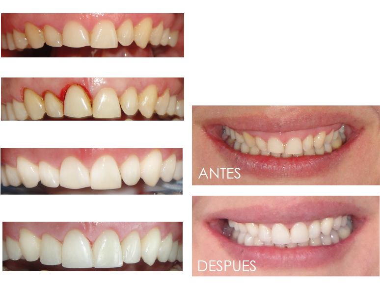 Como En Toda Obra De Arte La Capacidad Artística Del - Design (812x604), Png Download
