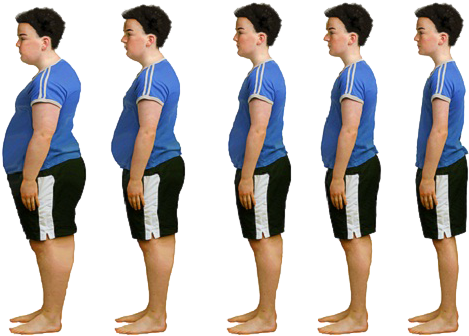 The Key To Success Is Childhood Obesity In Fanwood - Weight Loss Child (505x376), Png Download