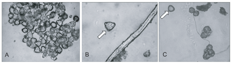 Wind-transported Apple Pollen Grains Observed On Pollen - Visual Arts (850x215), Png Download