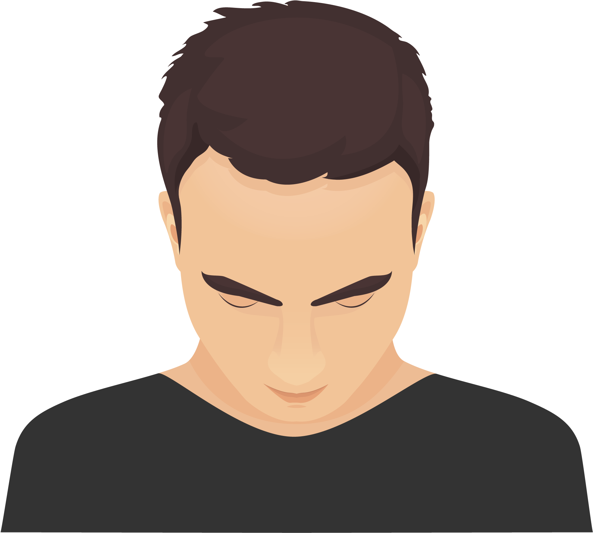Type 1 - - Pattern Hair Loss (2084x2084), Png Download
