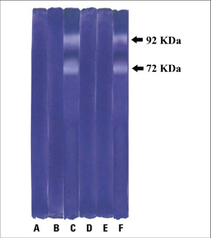 Effect Of Nomilin On The Activation Of Matrix Metalloproteinases - Nomilin (710x801), Png Download