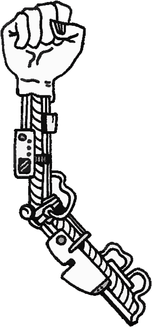 Surgeons Basically Dissect The Shoulder To Access The - Bionic Arm Clip Art (307x660), Png Download