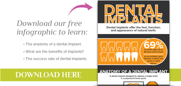 Anchorage Dentist - Dental Implant Offers (600x300), Png Download