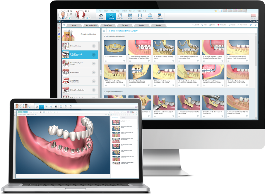 Dental Software Free Download - Chairside Dental (912x690), Png Download