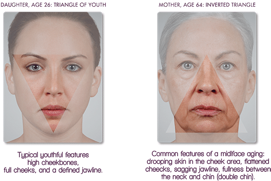 Mother And Daughter, Side By Side, Shows How The Contour - Face (600x415), Png Download