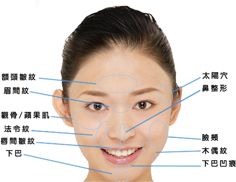 Radiesse-inject - Fasd Facial Features (580x357), Png Download