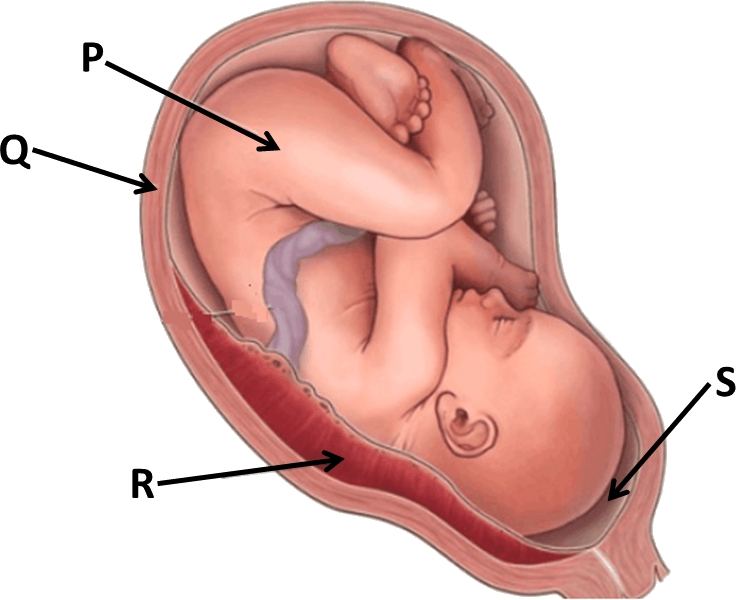 Image Showing Human Baby In Womb - Placenta Umbilical Cord Amniotic Sac Fluid (736x600), Png Download