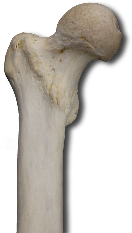 Proximal Anterior - Wood (540x850), Png Download