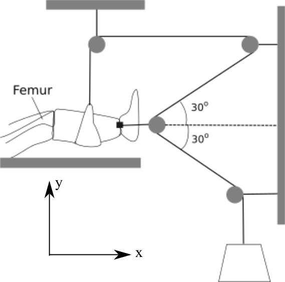 Femur 30° 30° - Force (569x563), Png Download