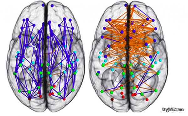 Brain Women And Men (600x600), Png Download