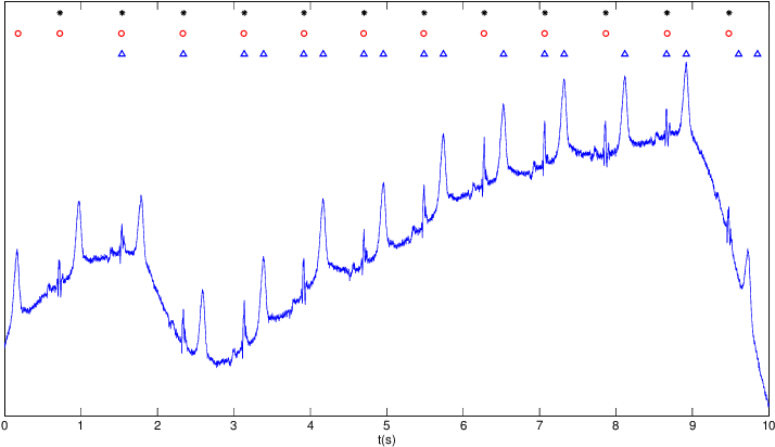 Ten Seconds Of Avl Lead Of Record S0131lrem - Calligraphy (720x413), Png Download