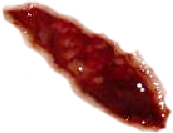 Wound Png Free Download - Blut Wunde Png (600x476), Png Download