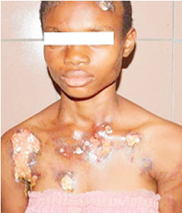 Health Worker Arrested For Inflicting Injuries (400x300), Png Download