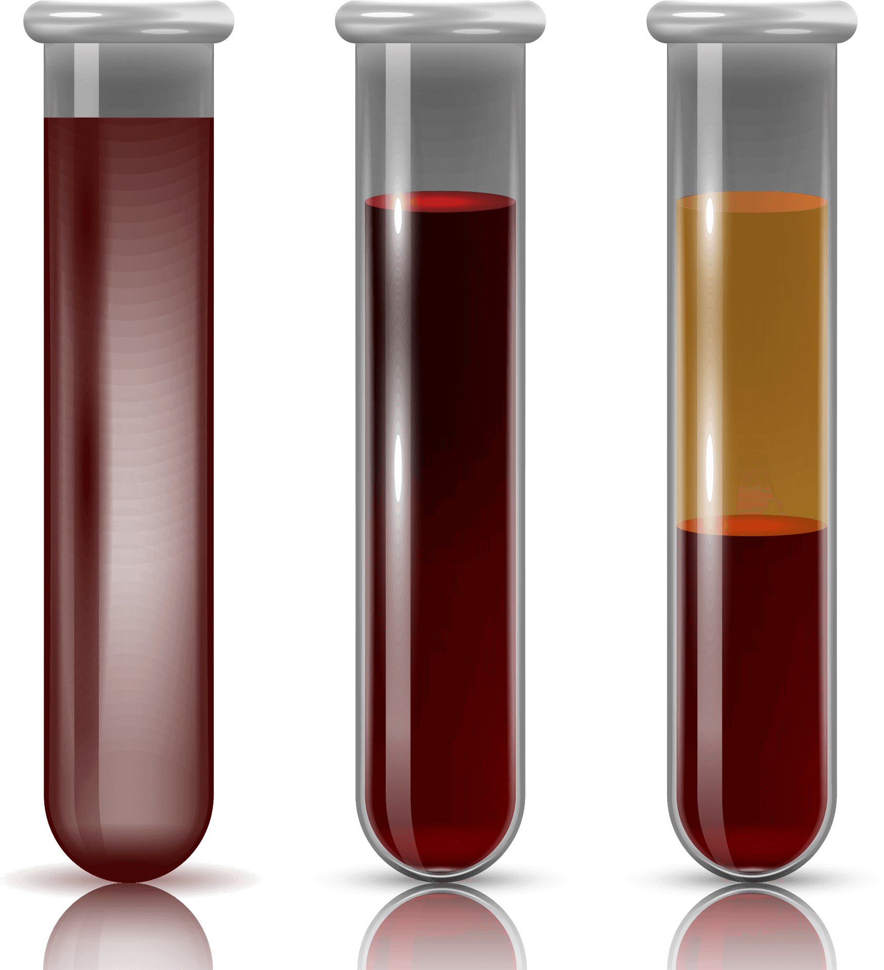 What Is Prp - Intravenous Therapy (1844x2008), Png Download