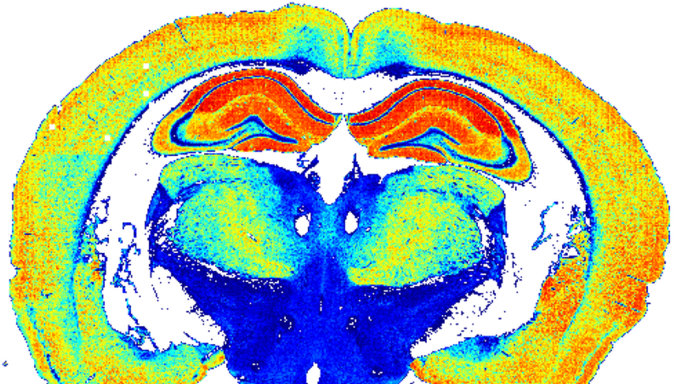 Article Update 82cf82e6 D658 45c5 A505 Adb114d9fdf4 - Brain (680x383), Png Download