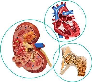 The Burden - Diagram (387x348), Png Download