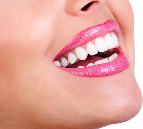 Teeth Whitening Centre London Ontario - Smile Teeth (640x426), Png Download