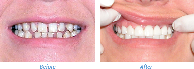 “i Always Hated My Smile - Tongue (620x230), Png Download