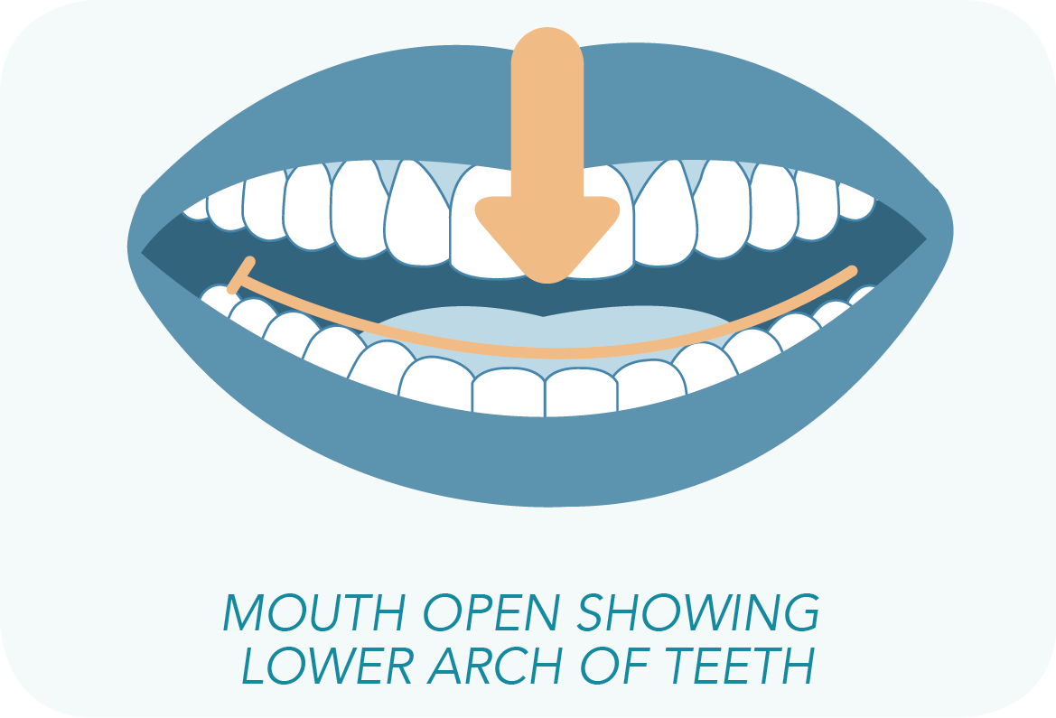 Want To Have An Impressions Doctor See If You're A - Mouth (1169x795), Png Download