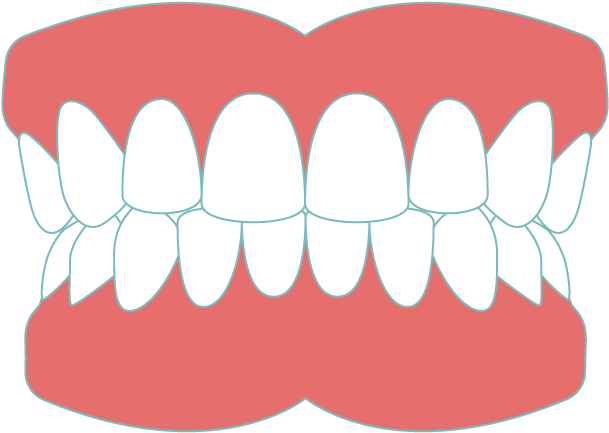 Dentures Sudbury - Greater Sudbury (1000x497), Png Download