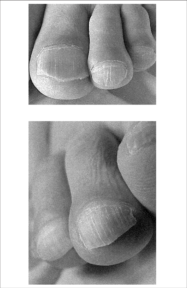 Case 2 - Graft (721x1108), Png Download