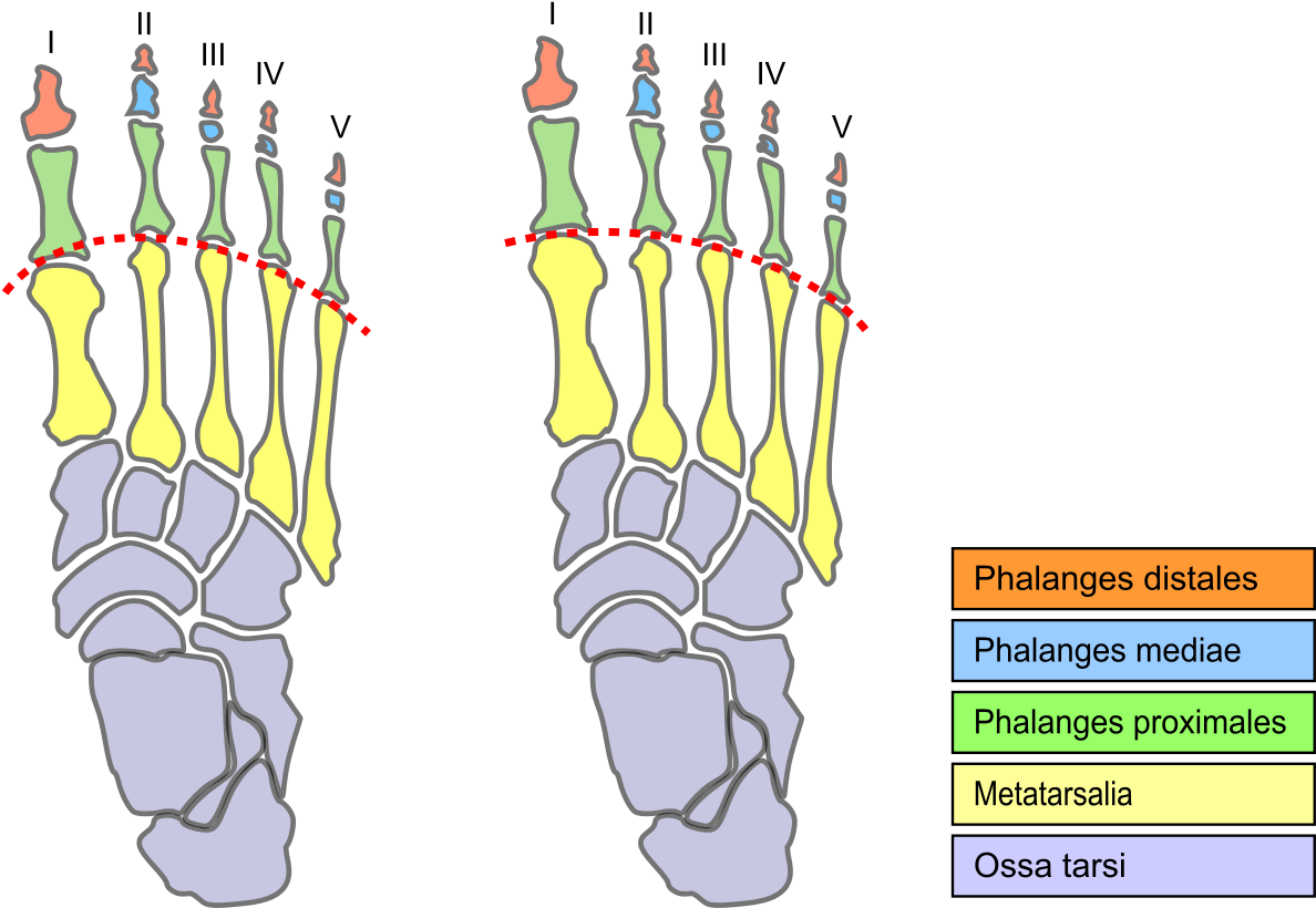 Morton's Foot (1200x837), Png Download