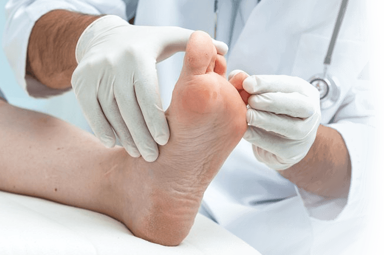 Podiatry Services - صور مسمار القدم (785x522), Png Download