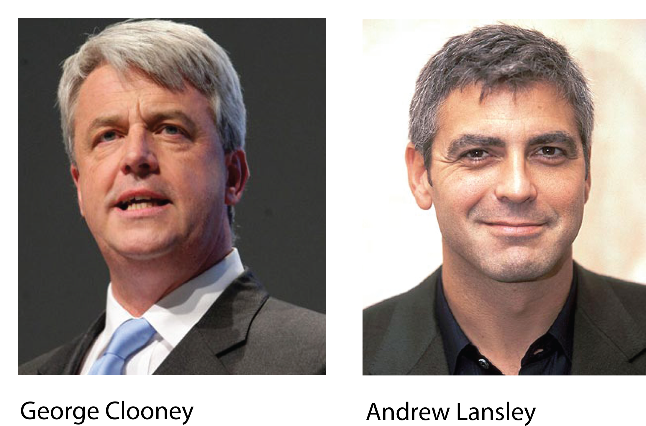 Health Reform Bill Movie To Star George Clooney As - Hair Loss Men Front (2235x1510), Png Download