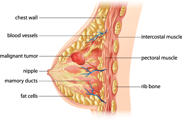 Breast Anatomy - Breast Cancer (600x452), Png Download