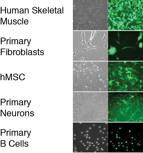 High-performance Transfection Of A Variety Of Human - Fibroblast Primary Cell (459x488), Png Download