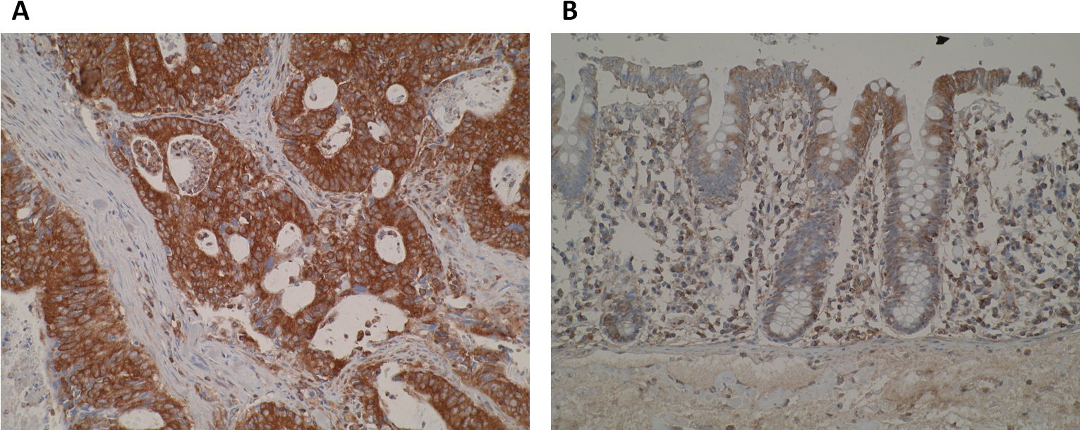 Immunohistochemistry Images Are Showing A Strong Cytoplasmic - Floor (1540x634), Png Download