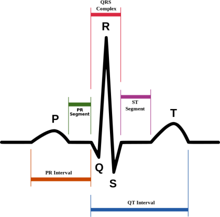 Schematic Representation Of Normal Ecg Trace With Waves, - Qt Interval (440x434), Png Download