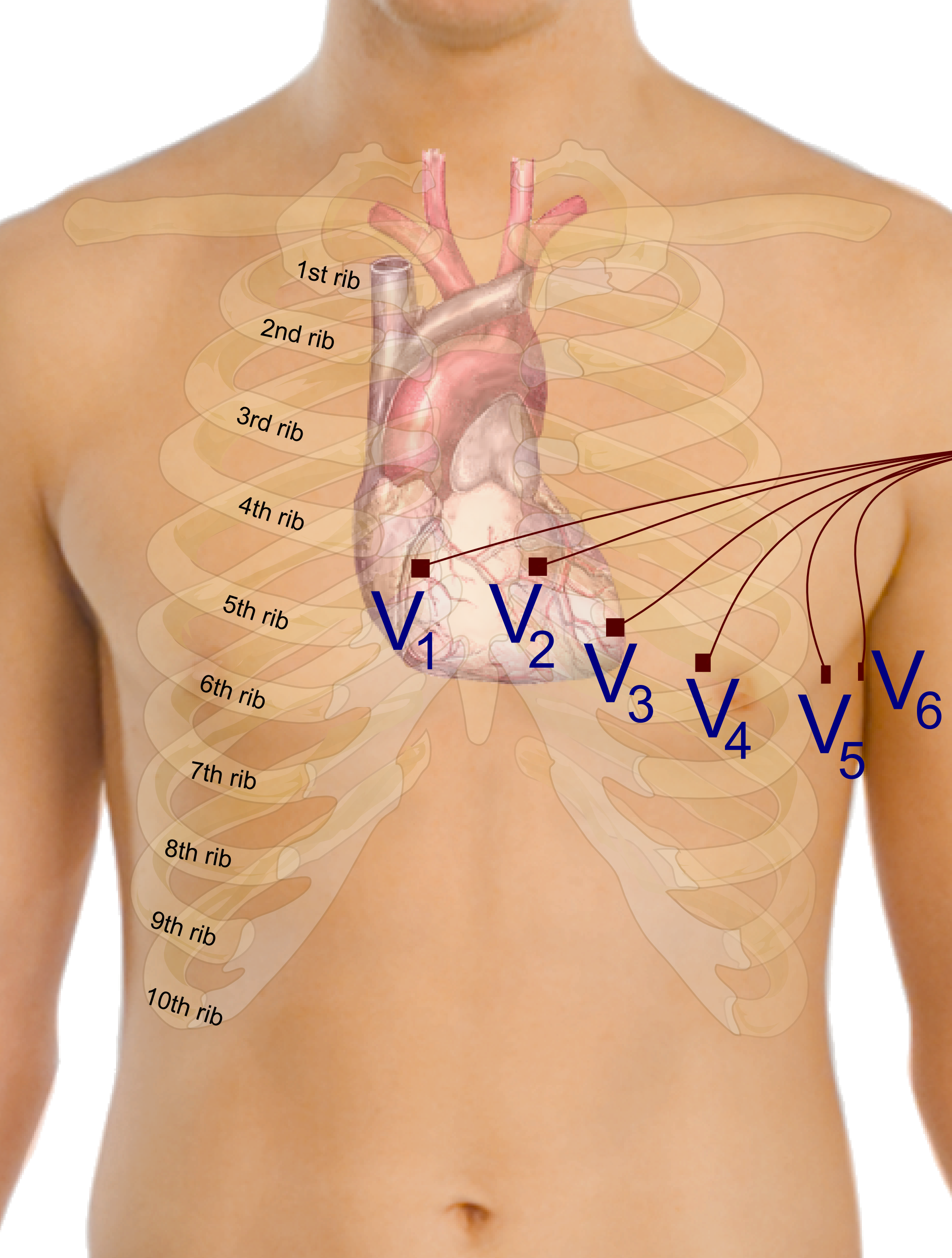 Precordial Leads In Ecg - Ecg For Beginners [book] (2067x2733), Png Download