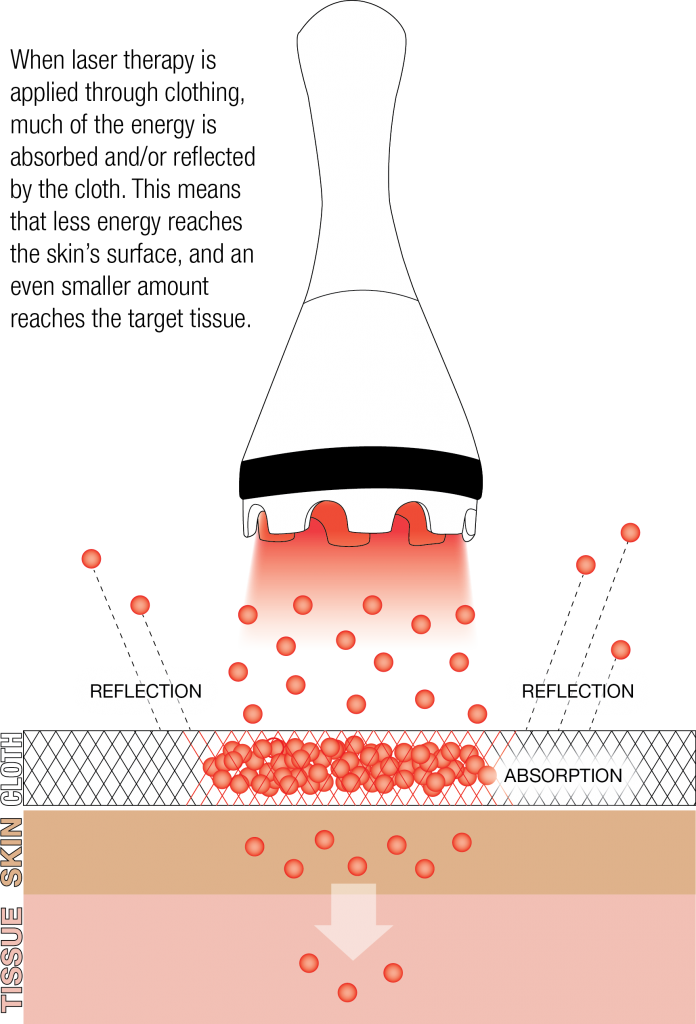 Treating Off Contact Clothing Thin - Diagram (696x1024), Png Download