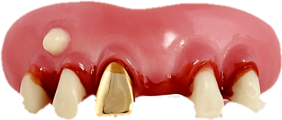 Finally We Have Rich Zombie Teeth - Gold Miner Billy Bob Teeth (480x651), Png Download