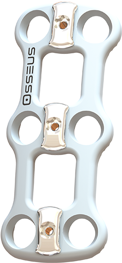 White Pearl Cervical Plate - Gun Barrel (594x600), Png Download