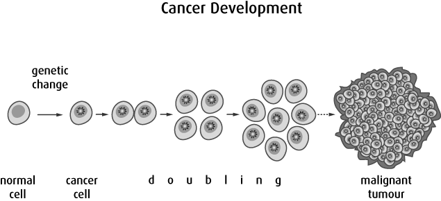 Other Forms Of Cancer Treatment, Such As Chemotherapy - Tumeur Bénigne Et Maligne (635x290), Png Download